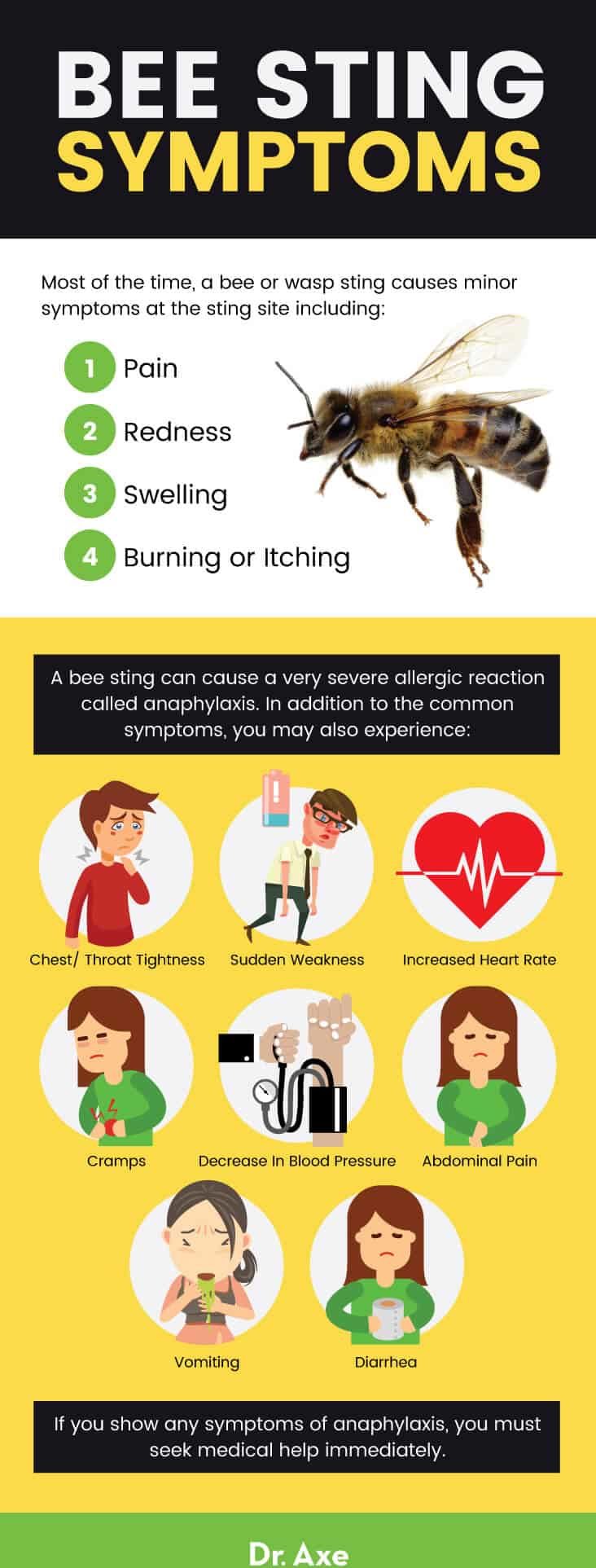 Bee sting treatment: bee sting symptoms - Dr. Axe